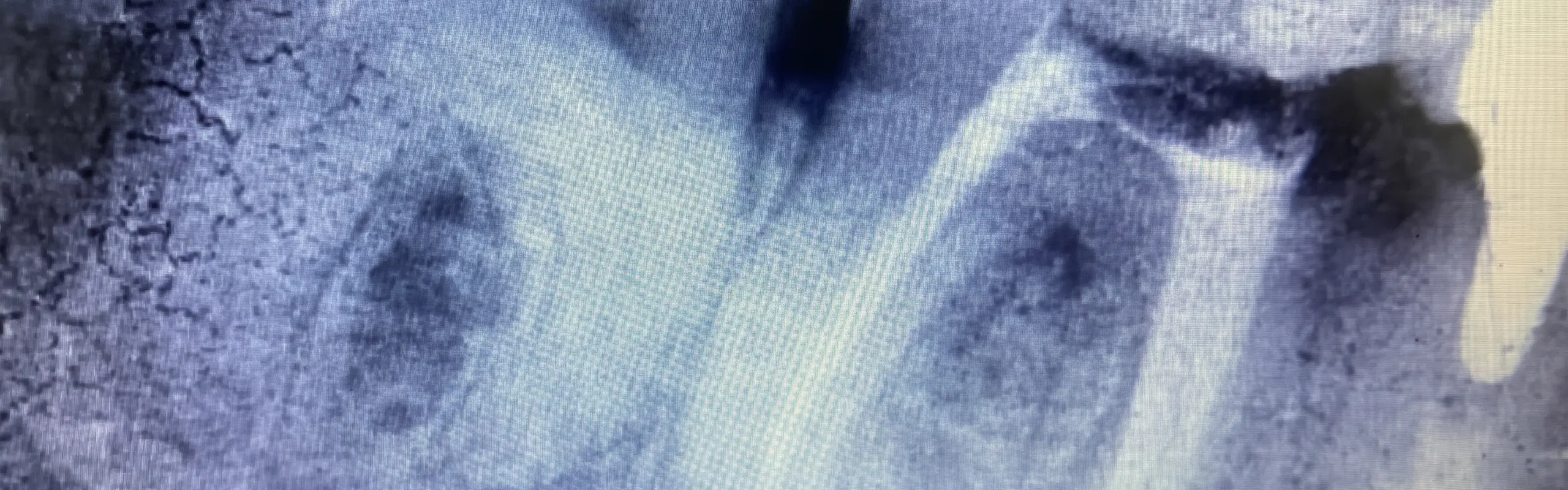 Radiografia odontológica